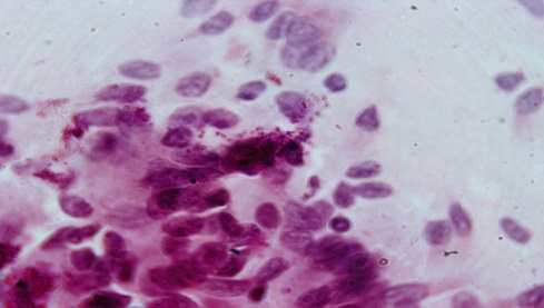 Рис.1 Световая микроскопия на хламидиоз окрашенная по Романовскому-Гимза