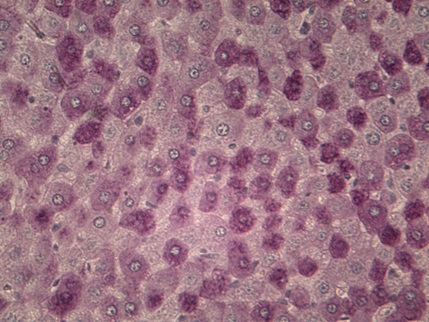 Клетки печени крыс. Гликоген в печени человека фото гистология. Метод Шабадаша. Окраска по Шабадашу цель и результат.